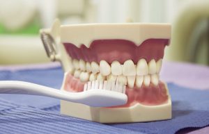 Aggressive teeth brushing causes receding gums! | Gum Grafts Ottawa