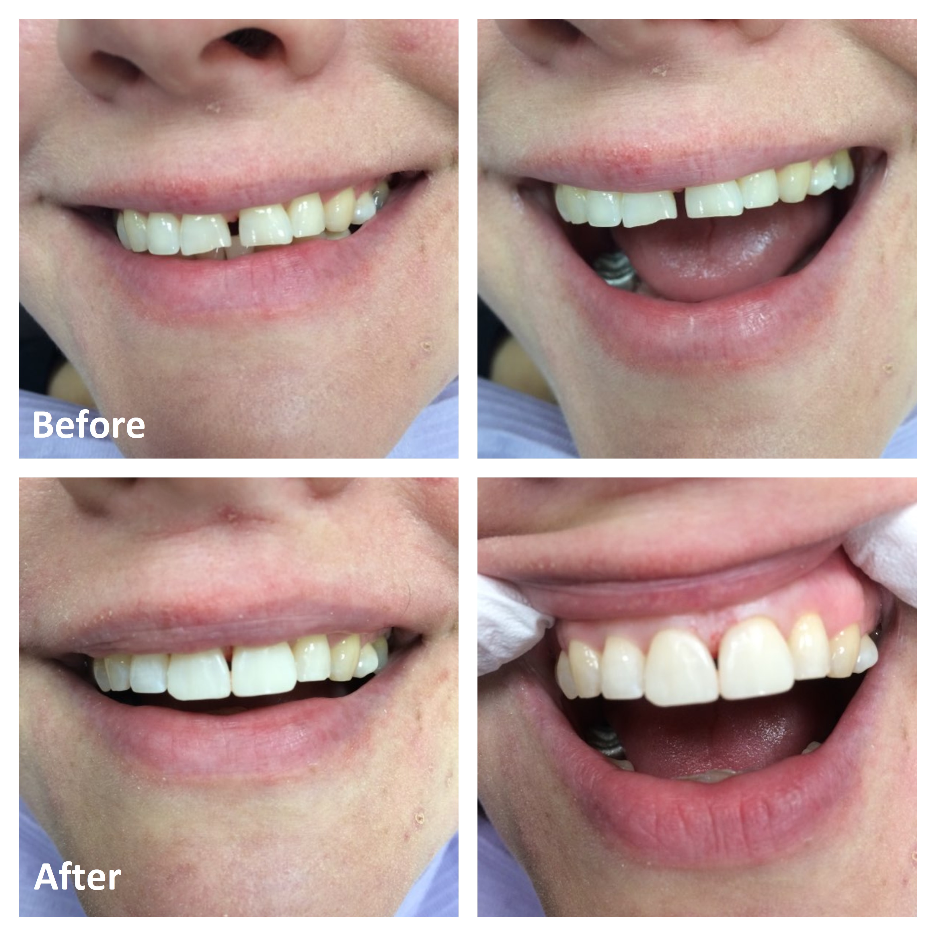 Dentistry Before and After Photos