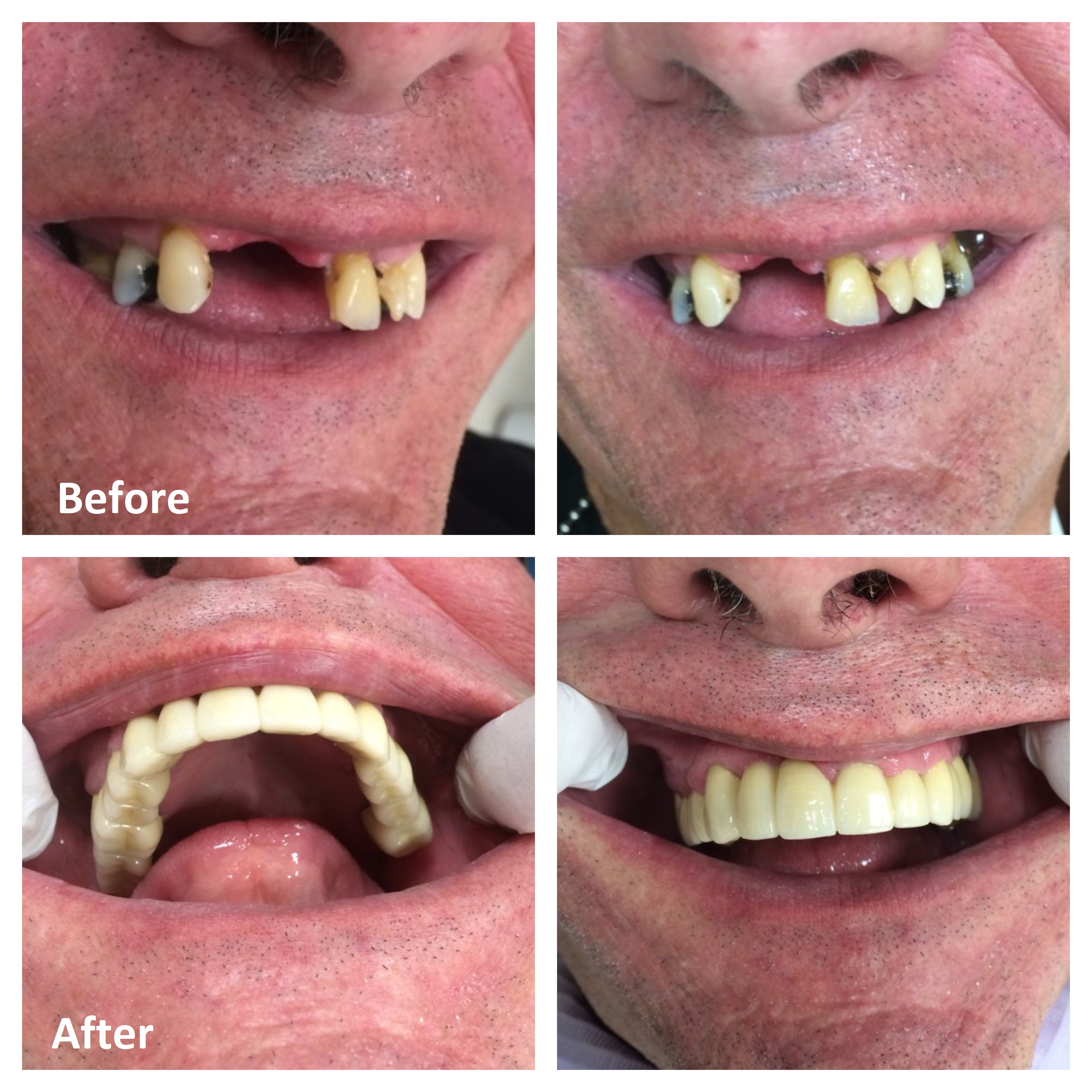 Teeth makeover on sale