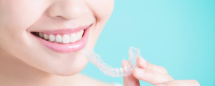 Teeth Whitening Kit Ottawa | Teeth Whitening Ottawa | Rockcliffe Dental