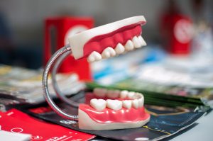 Everything You Need to Know about Dentures in Ottawa